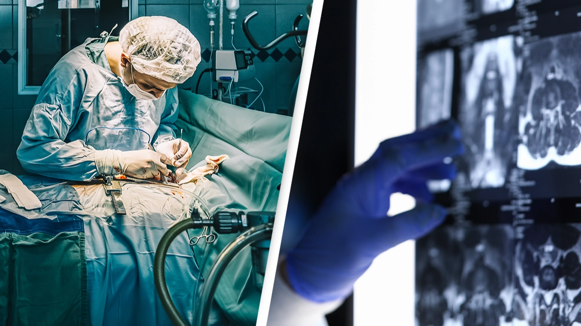 Doctor 'catches' cancer from patient while he was performing surgery in unbelievably rare case