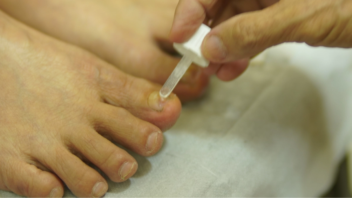 Experts issue warning to state as one dead and over 30 people left seriously ill after contracting fungal infection