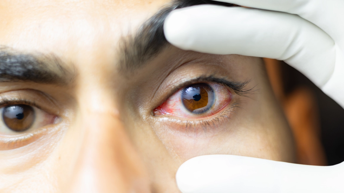 Experts list seven changes to your eyes that you should 'never' ignore