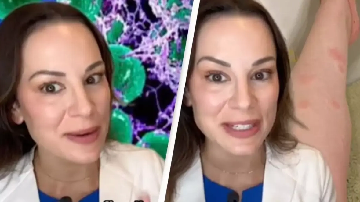  Expert reveals gross reason why mosquitoes like some people a lot more than others