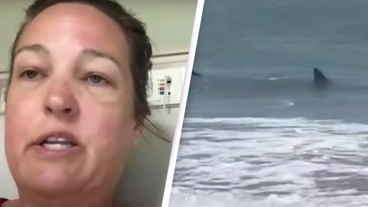 Woman recalls her terrifying escape after being mauled by shark in one of 'extremely rare' back-to-back attacks