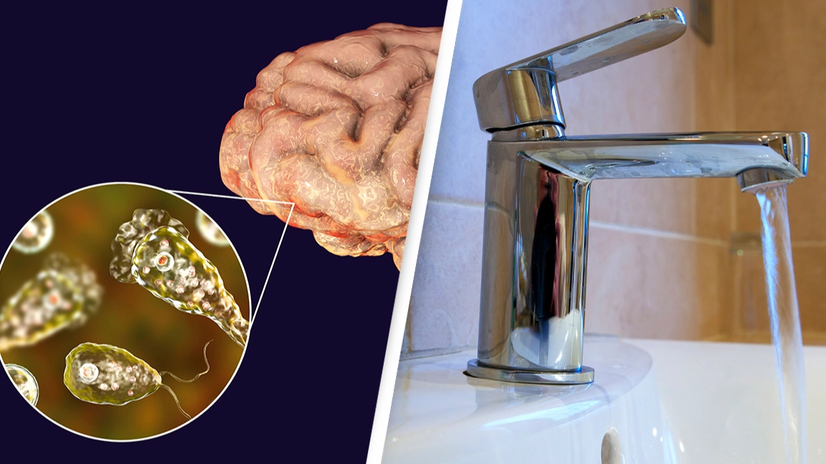 Florida man dies from brain-eating infection after rinsing nose with tap water
