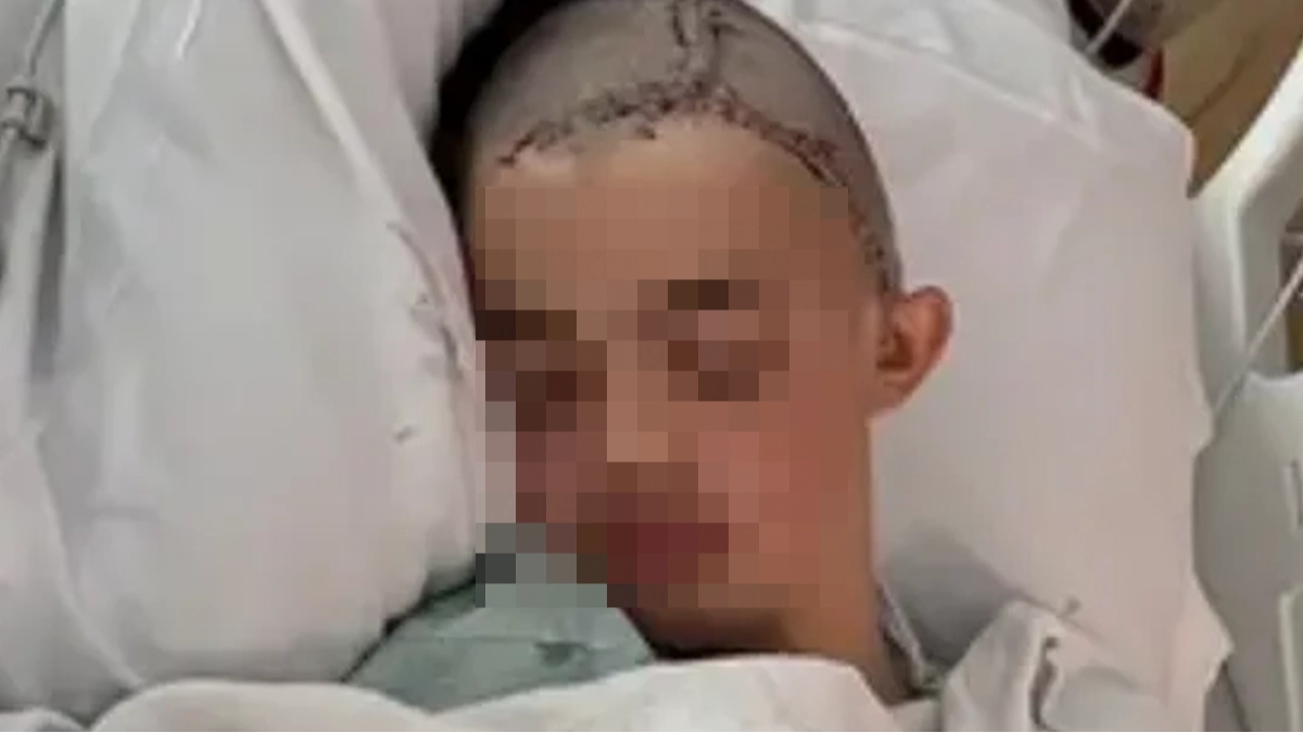 Teen 'attacked by fellow student after making joke' has his head put back together as family release shocking update