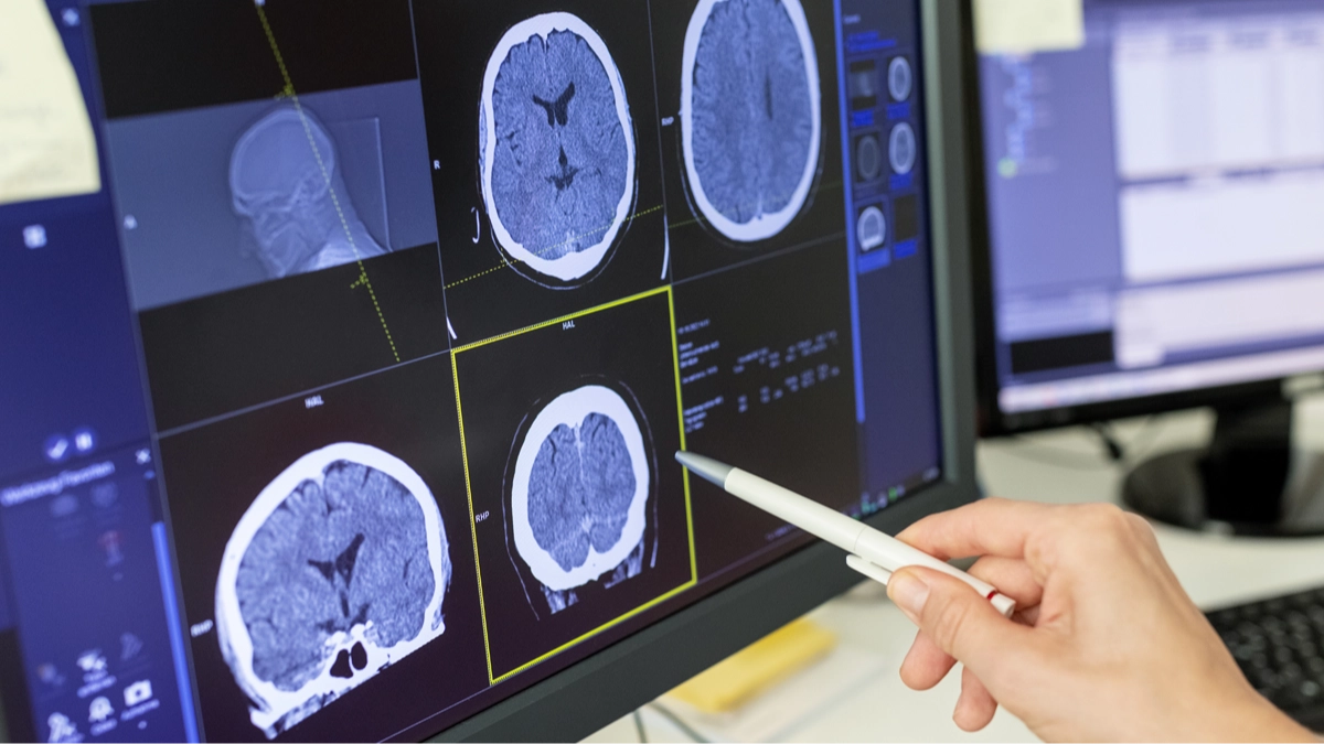 Neurologists warn that you should never ignore these eight symptoms