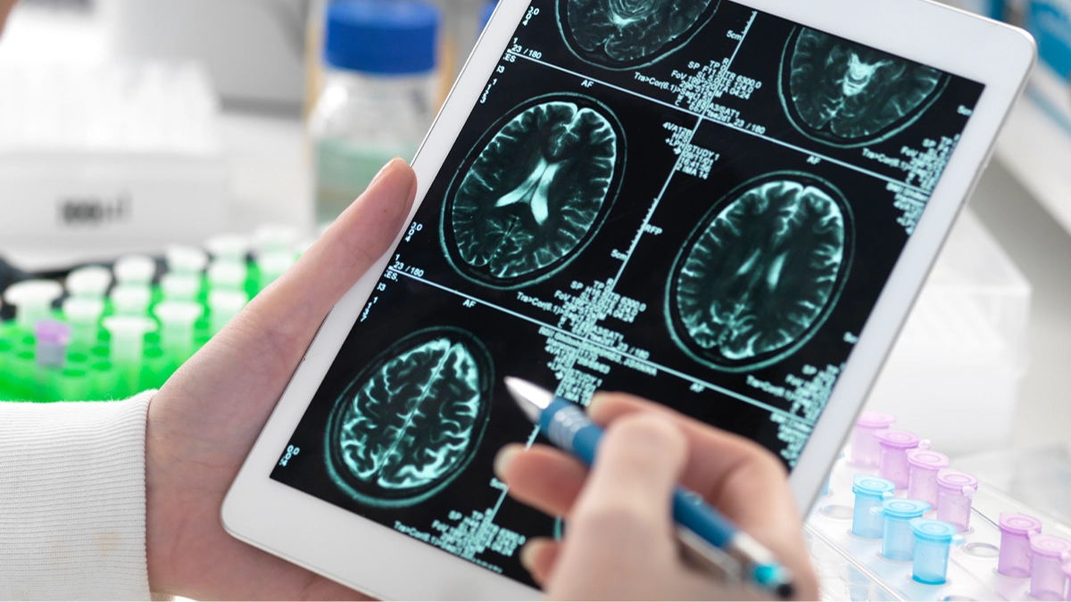 Study finds that eating one common 'superfood' could cut Alzheimer's disease risk by almost 50%