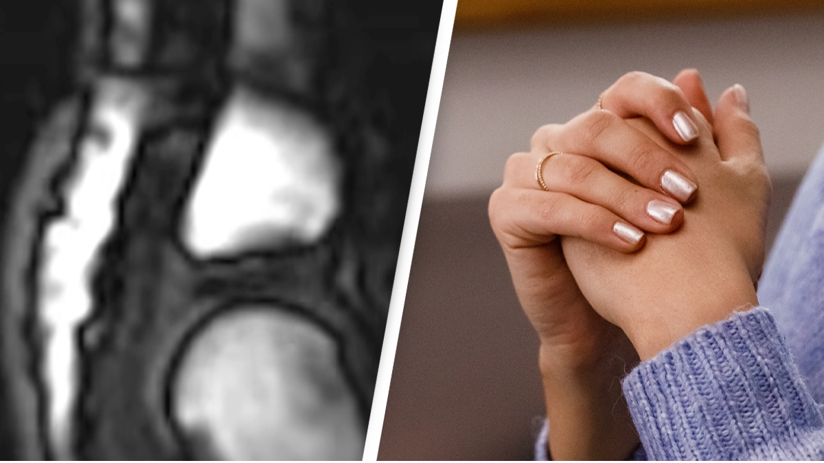 People are just learning what actually happens when you crack your knuckles