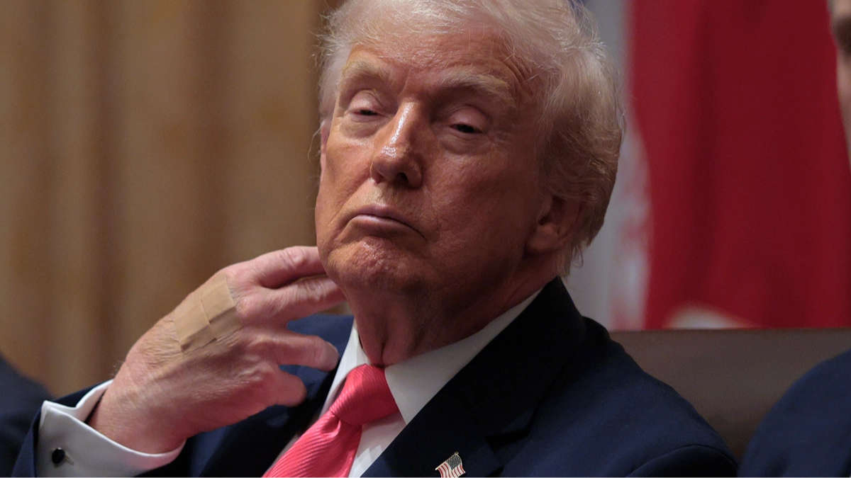 White House finally reveals surprising reason why Trump has bandages on his hands