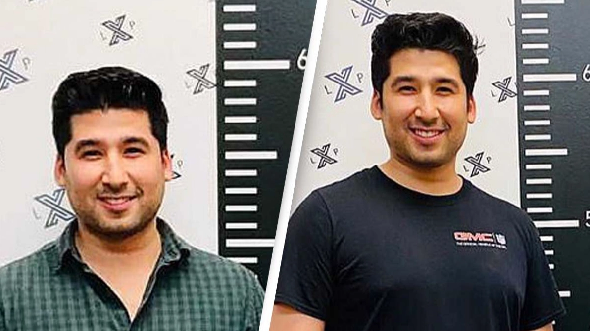 Men are paying $275,000 to have their legs broken in effort to get taller