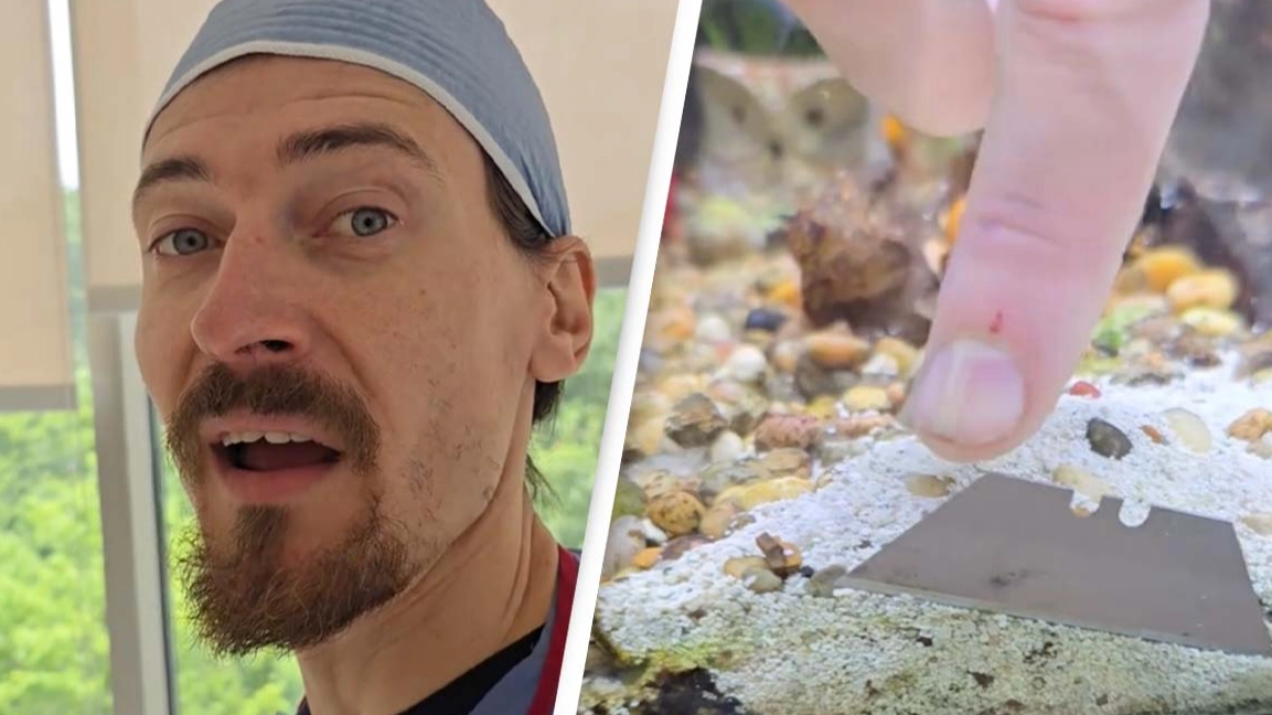 People warn man he may have cancer after spotting concerning mark in video that got millions of views