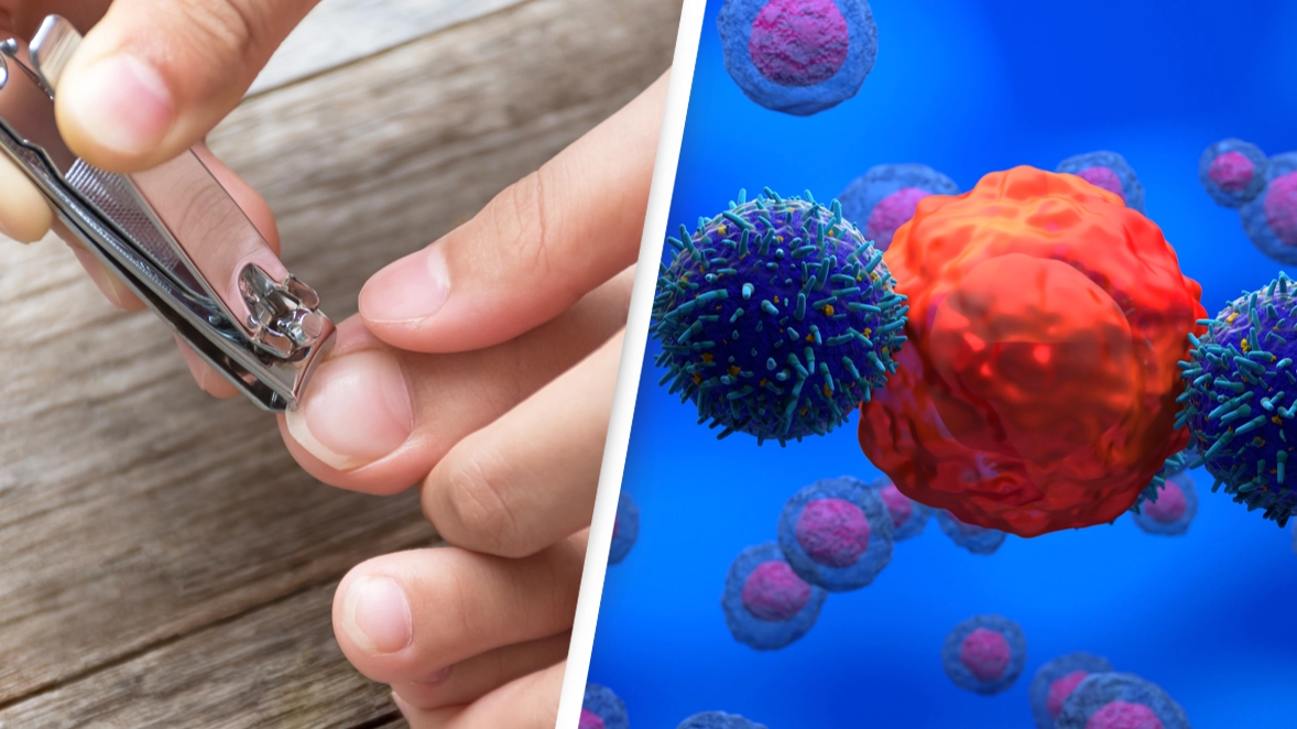 Doctors warn of little-known cancer symptom you can see on your toenails