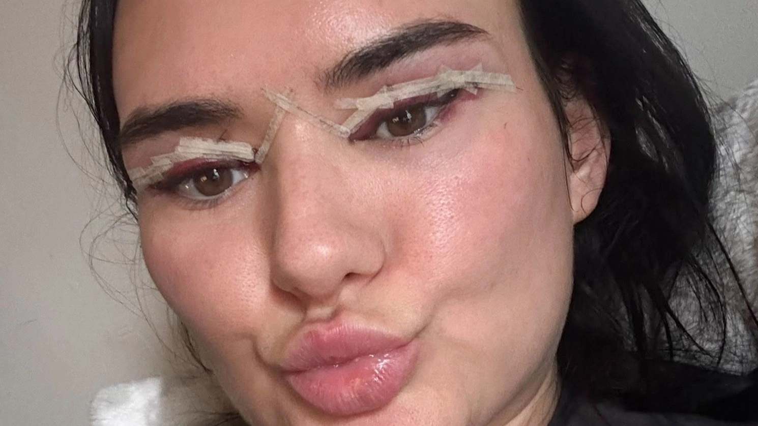Woman issues warning after getting 'influencer' eyelid lift surgery that left her eyes 'bleeding'
