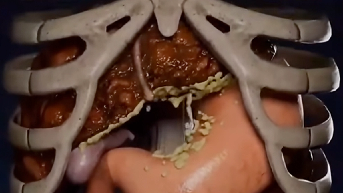 Dangers of fasting as shocking simulation shows the extreme impact of doing it for 36 hours