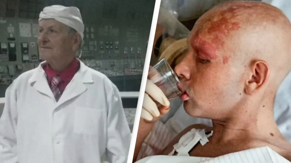 Chernobyl survivors share the horror symptoms they still suffer from 37 years later