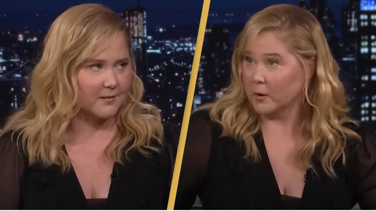 Amy Schumer responds to criticism over her ‘puffier’ face