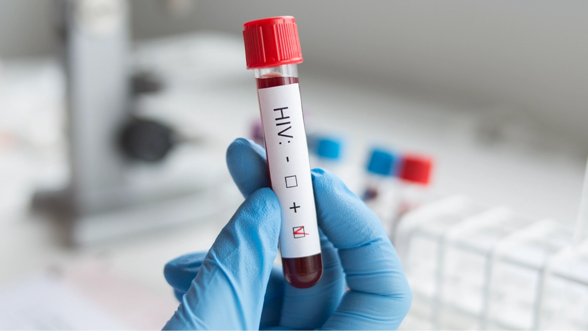 Difference between HIV and AIDs as experts warn of 3.3 million new cases