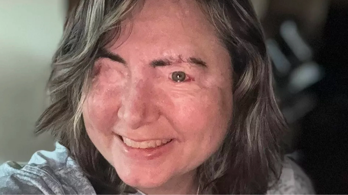 Woman recalls 'leaving her body' as abusive husband poured chemicals into her eyes