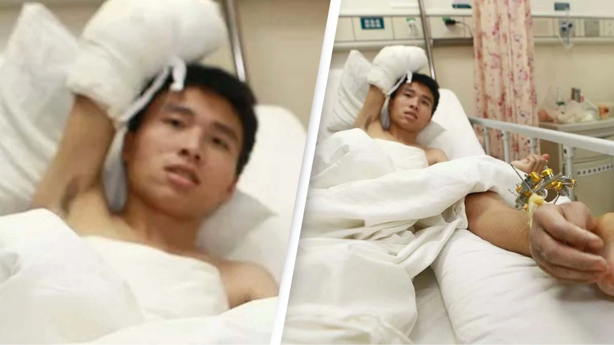 Doctors attach man's hand to his ankle after it was cut off in an accident