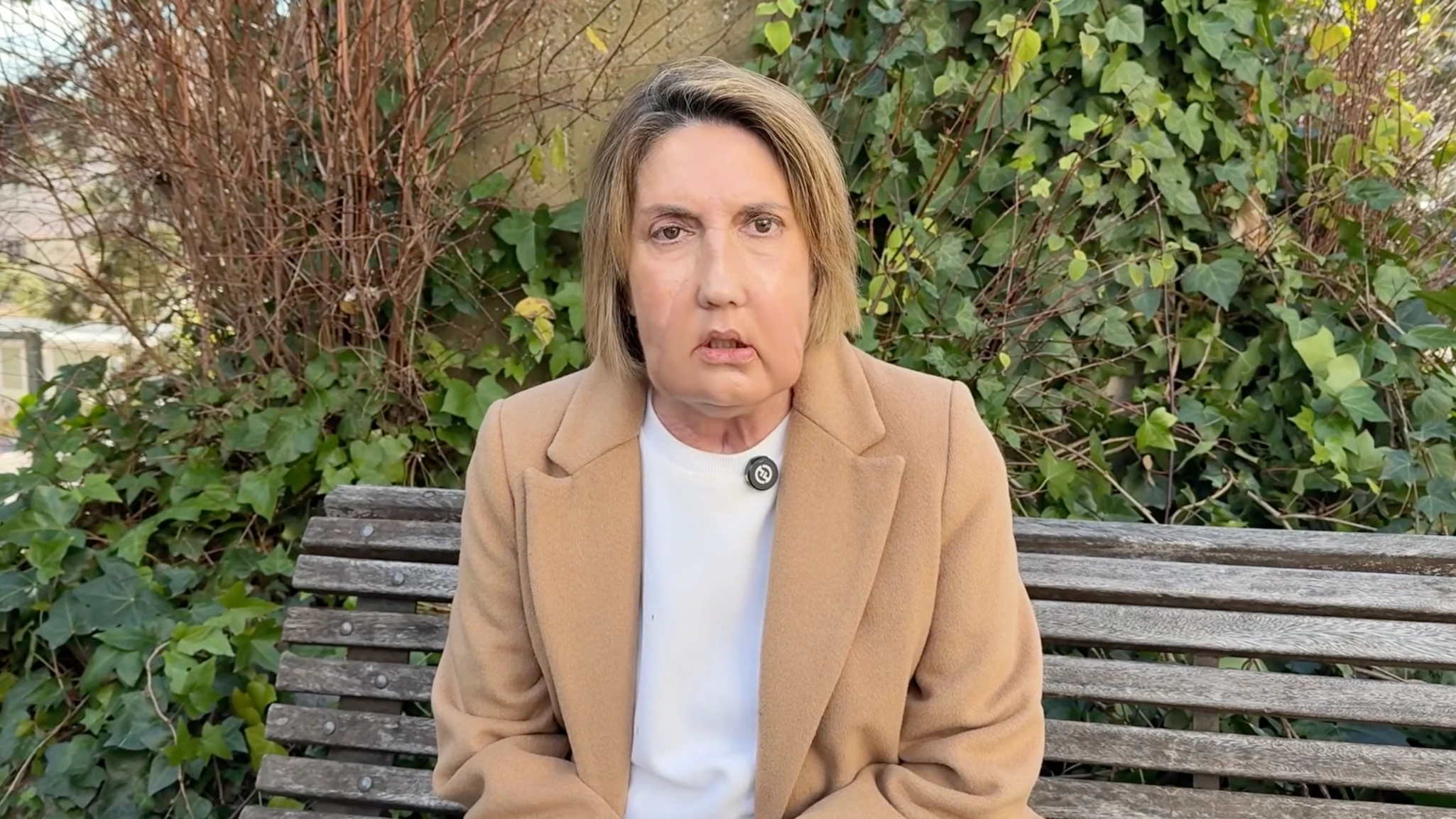 Woman receives face transplant after donor requested assisted dying