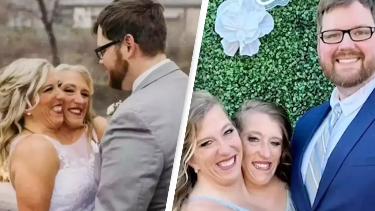 People are asking the same thing after finding out conjoined twin Abby Hensel is married