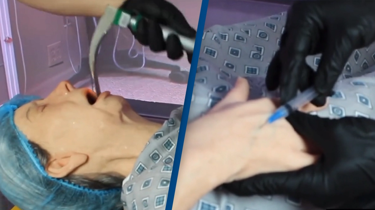 Woman shows 'terrifying' reality of what really happens when you get put under for surgery