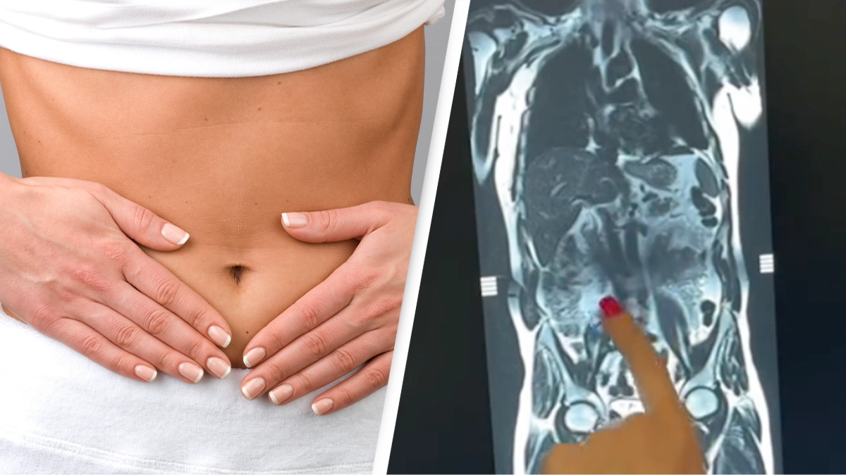 People saying 'childhood was a lie' after learning the actual location of our stomachs