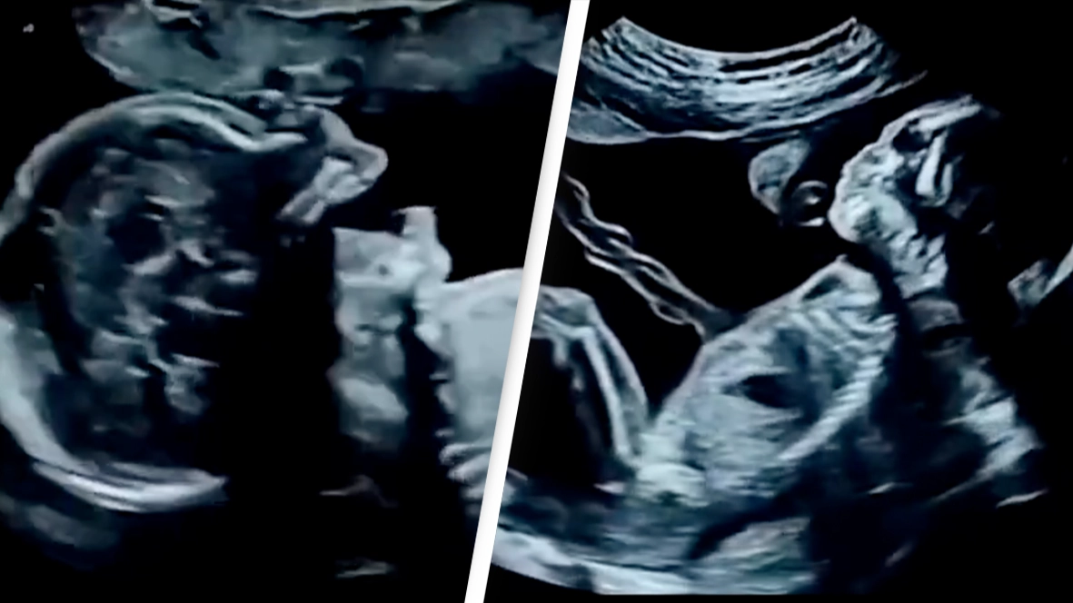 Amazing footage of what babies actually do in the womb is leaving people stunned