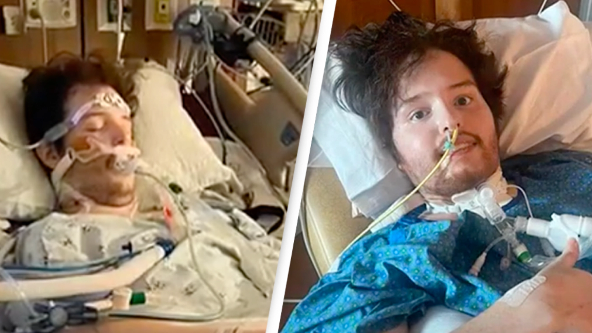 Man 'given a 1% chance of survival' after years of vaping left him on life support