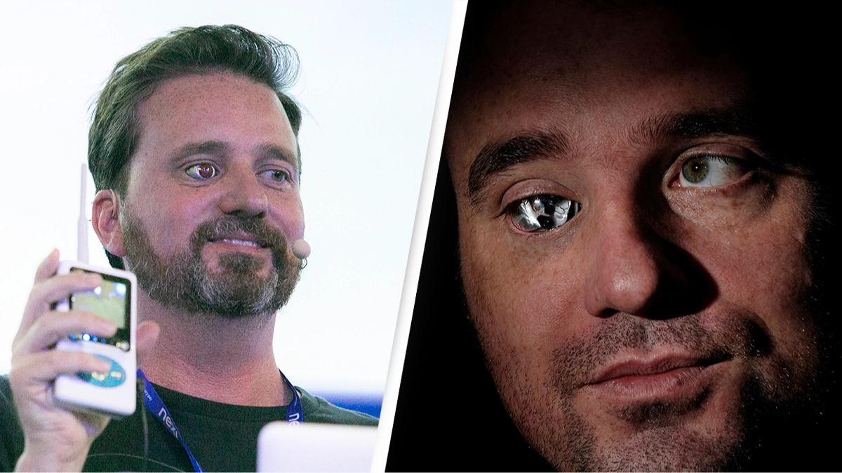 Man who lost his eye explains why he replaced it with a wireless camera