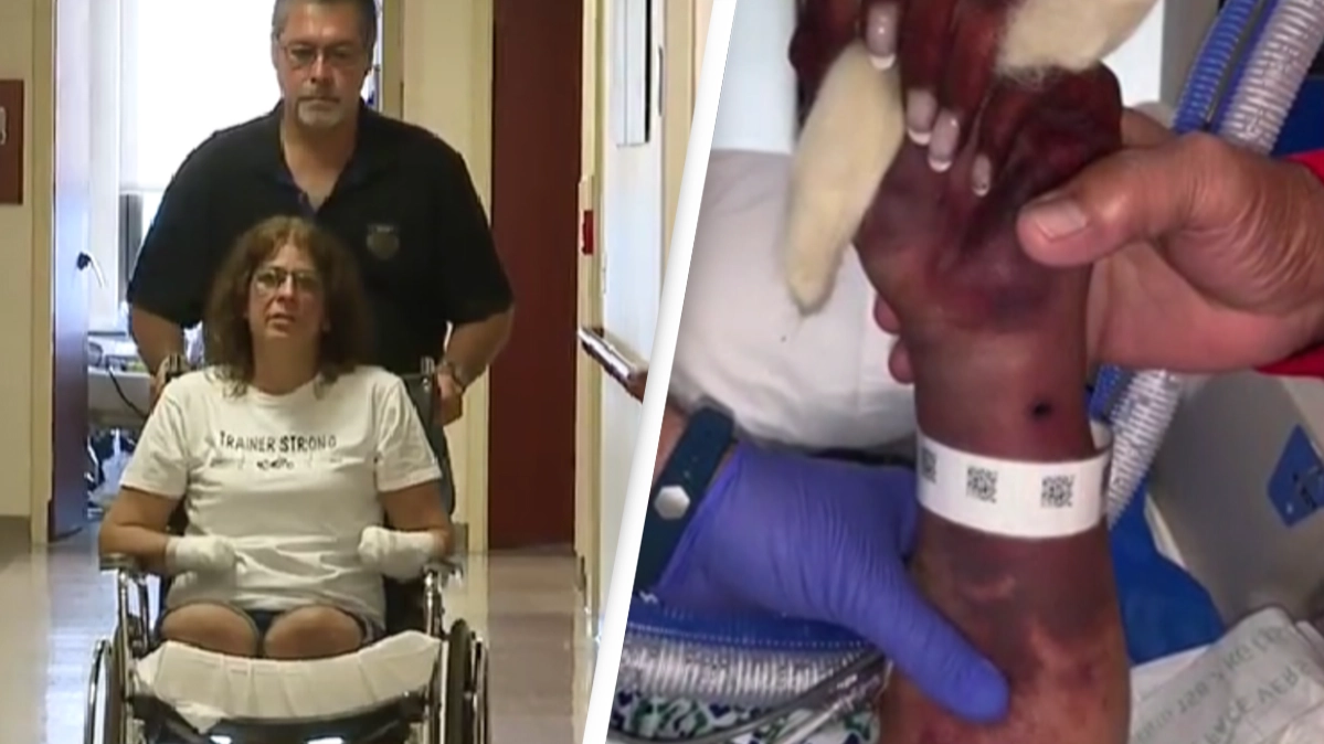 Woman who had arms and legs amputated after dog licked her speaks out about ‘challenging’ time