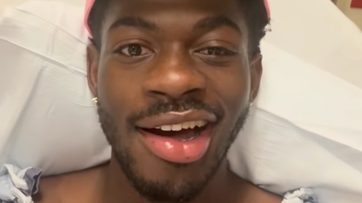 Lil Nas X shares right side of his face is paralyzed following hospitalization
