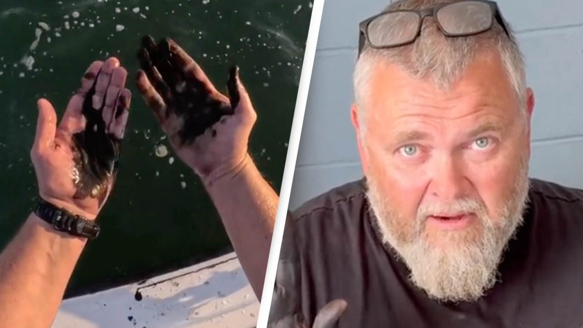 People stunned after seeing what happened to man five days after he rubbed squid ink on himself