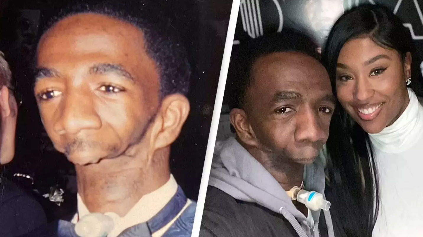 Man born without a jaw who can't speak, eat or breathe properly has found love with wife