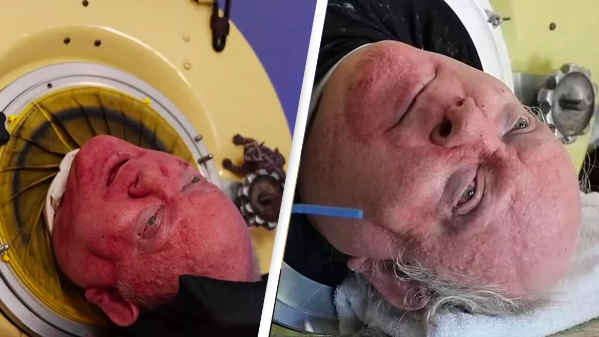 Man who lived inside seven foot iron lung for over 70 years has died aged 78