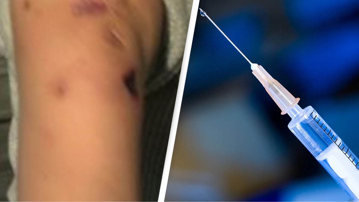 The FDA looks to crack down on terrifying new drug which can cause 'rotting' flesh
