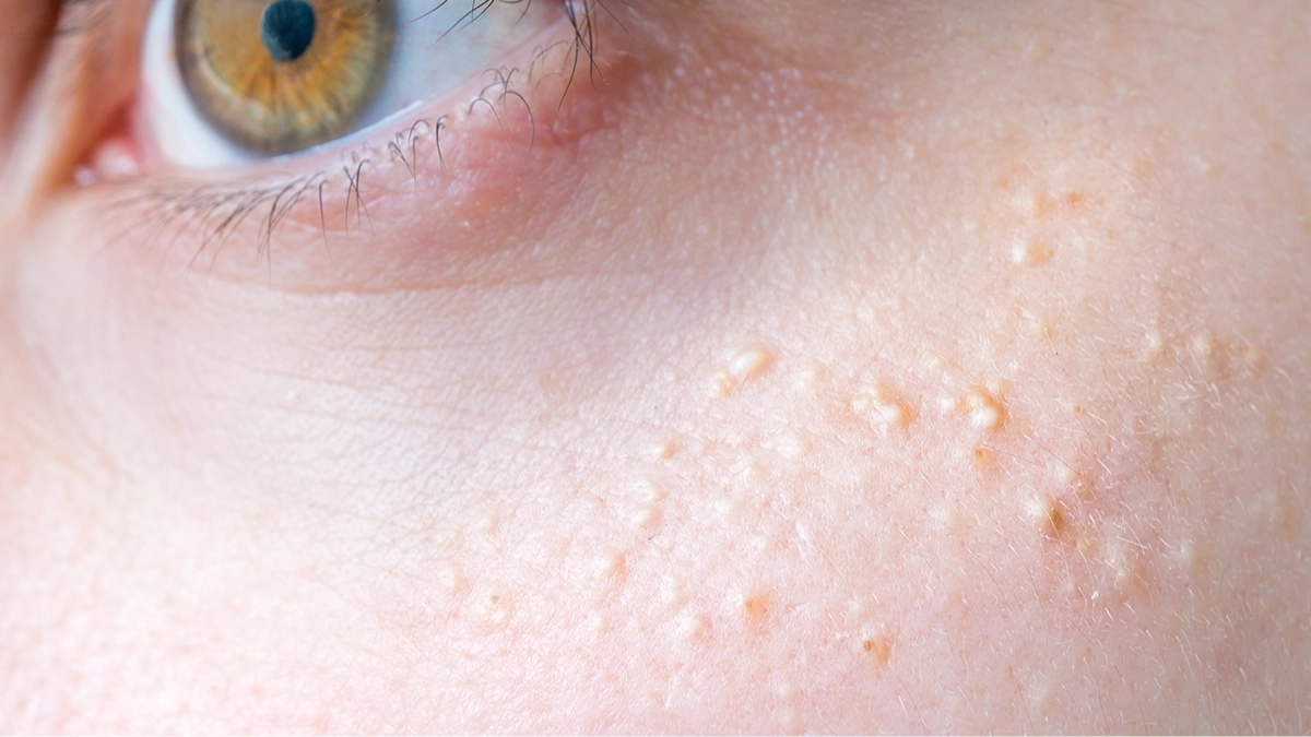 Reason behind series of white spots on your body and private parts as experts issue serious warning