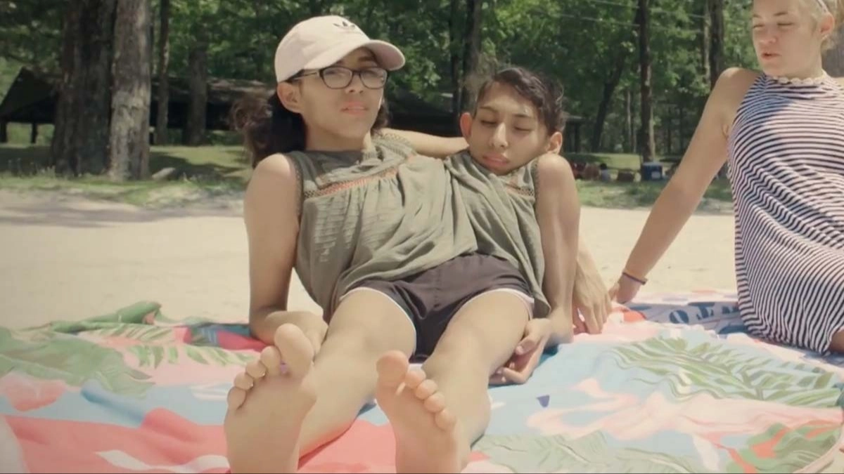 Conjoined twins respond to comments about marriage and decision on having kids