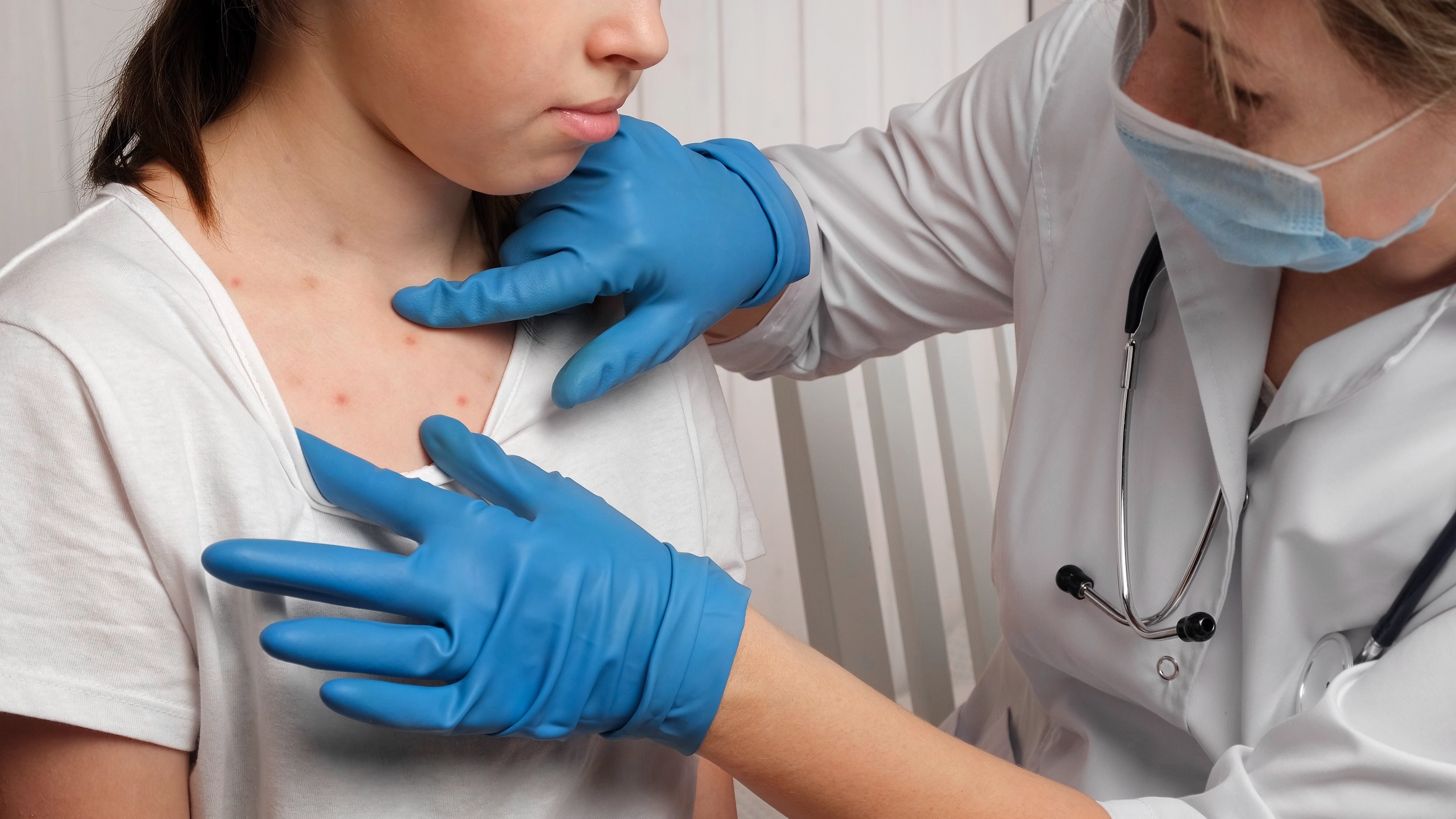 Doctor issues major warning not to have 'measles parties' and reveals serious health risks