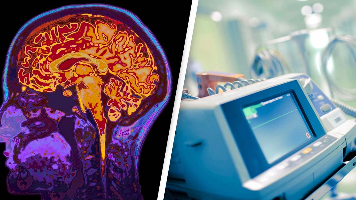 Ground-Breaking Study Suggests What Happens In Brain In Final Moments Before Death
