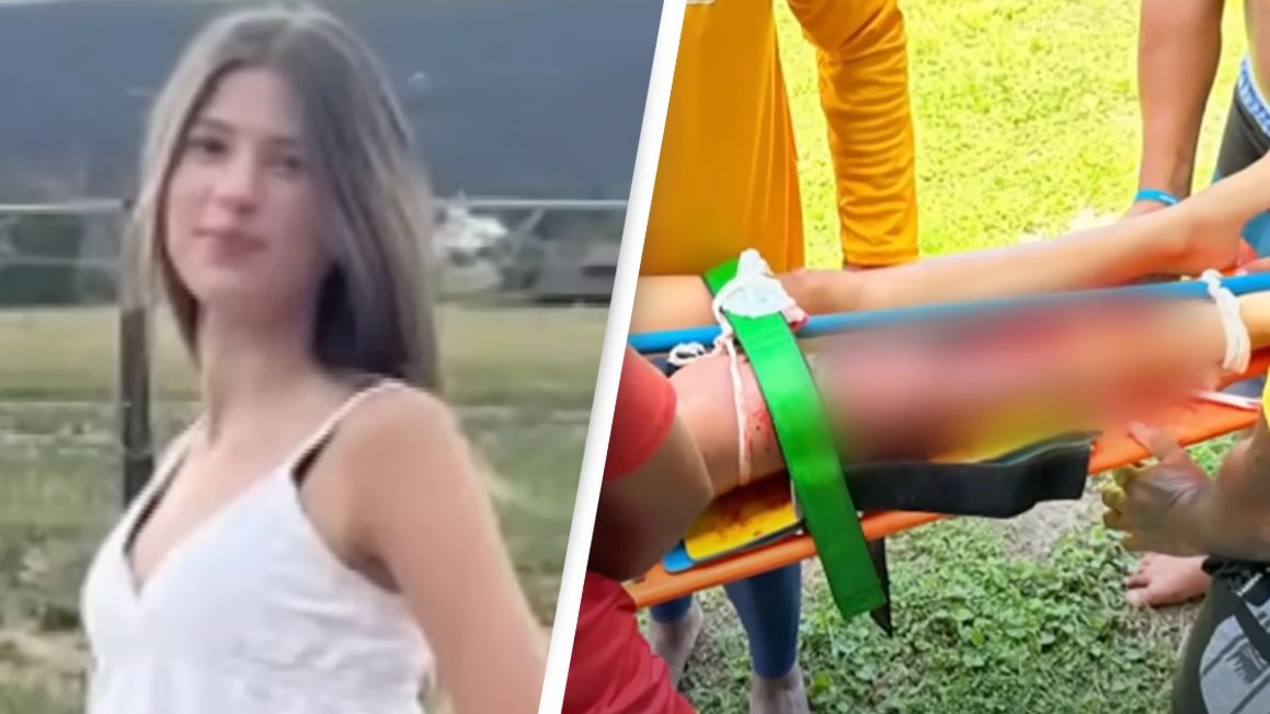 Teen details moment her leg was ripped off during horrific shark attack