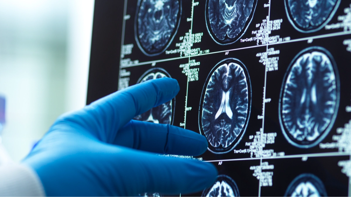 Early warning sign of dementia may be visible through your bank account, study finds
