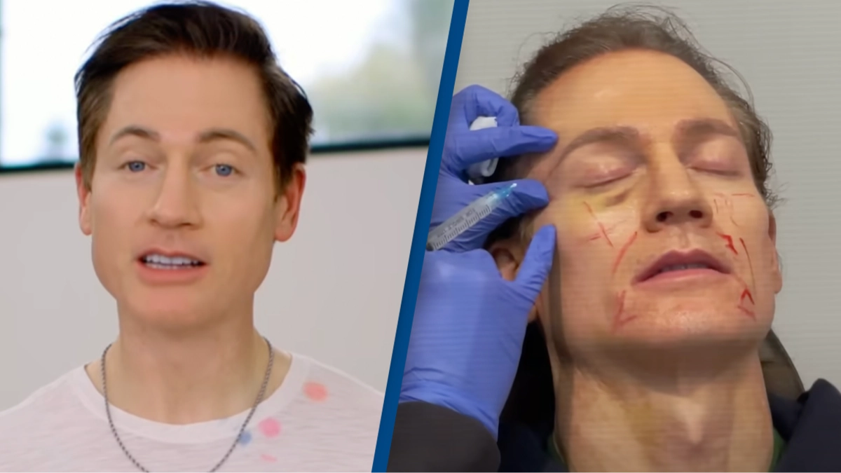 Pictures of biohacker before he began spending $2,000,000 a year to 'live forever' leave people stunned