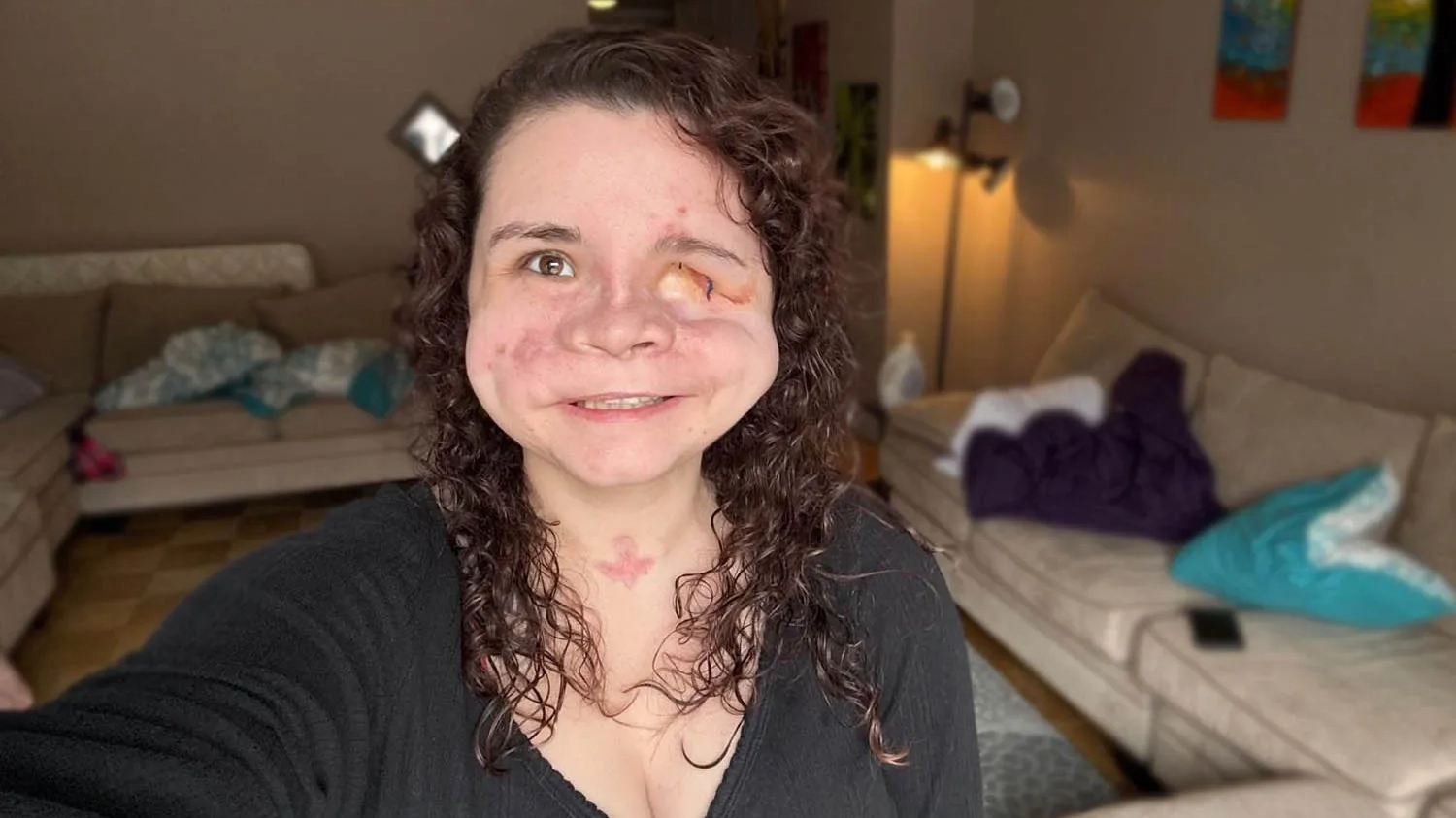 Woman given ‘less than 2%’ chance of survival after being shot in the face shares important message about horrific trauma