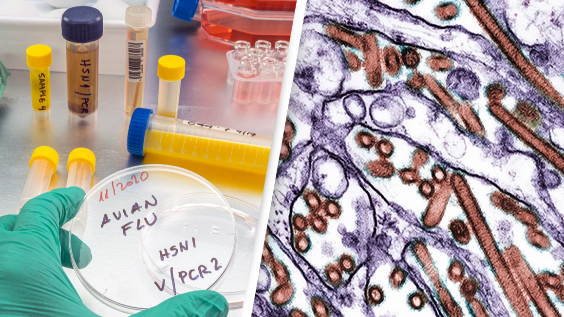 Man becomes first human in US to die from bird flu as authorities issue symptoms to look out for