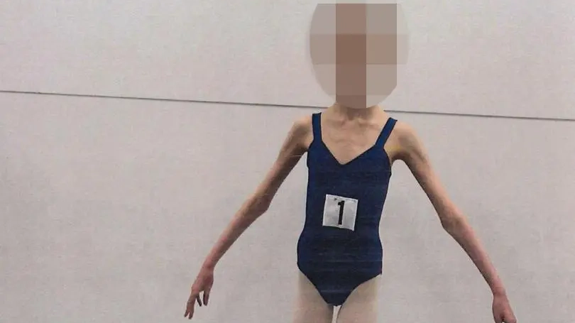 Parents who starved ballerina daughter to try and keep her a 'little girl forever' sentenced to prison