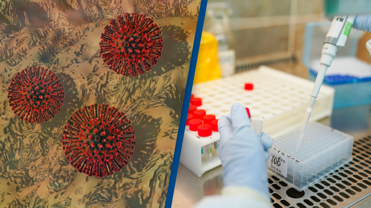 First known case of person simultaneously testing positive for Covid-19, HIV and monkeypox