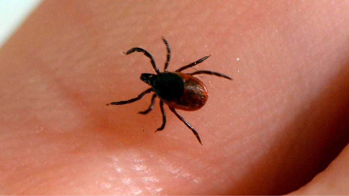 Doctor issues warning over hidden symptoms of Lyme disease as tick bites near record highs in US states