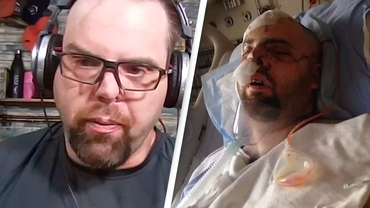Man shares first-hand account after he survives being bitten in the head by bear