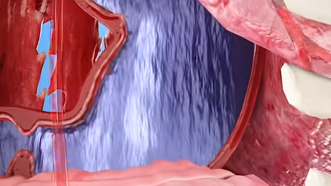 Terrifying simulation shows fatal reality of what would happen if you drank too much water