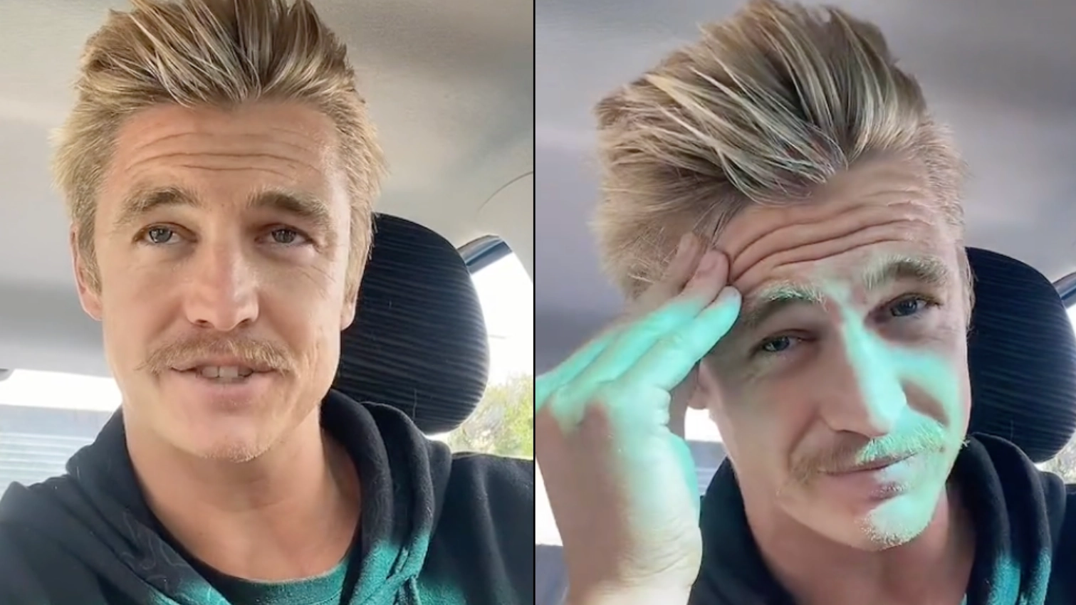Man Who Hasn't Washed His Hair In Six Years Says It Stopped It Falling Out