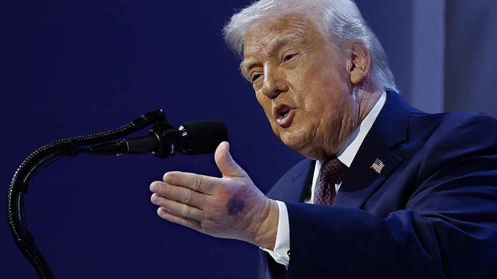 White House responds as changes to bruising on Trump's hand go viral
